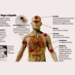 Impactos de la droga Krokodil en la salud humana