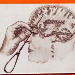 Impactos de la lobotomía en el cerebro humano