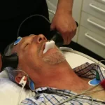 Innovaciones y beneficios de la terapia electroconvulsiva