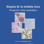 Profundiza en el fenómeno de la citolisis celular