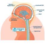 Secretos de los Plexos Coroideos: Funciones y Relevancia Médica