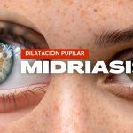 Secretos y causas detrás de la midriasis