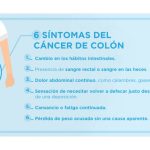 Señales del cáncer de colon: lo que necesitas saber