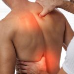 Afecciones Neuromusculares: Comprensión y Perspectivas Actuales