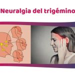 Alivio y tratamiento para la neuralgia del trigémino