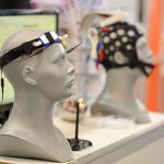 Aplicación del neurofeedback en el tratamiento del TDAH