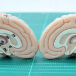 Avances en la Psicología del Cerebro Clínico