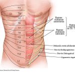 Causas de los pinzamientos abdominales