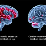 Cómo la terapia EMDR aborda el trauma eficazmente