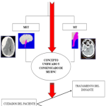 Comprende el fenómeno de la muerte cerebral