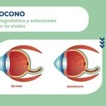 Comprende las causas y soluciones para la fotofobia