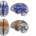 Conexiones entre los hemisferios cerebrales