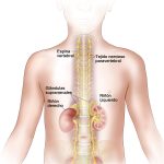 Conoce lo esencial sobre el neuroblastoma en niños