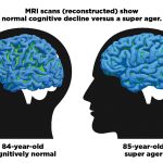 El enigma detrás de las neuronas Von Economo