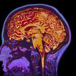 Hablar varios idiomas protege contra el Alzheimer