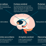 Identifican características cerebrales en personas con TDAH