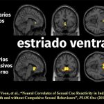 Impacto del porno en el cerebro humano