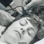 Impacto y Efectos del Electroshock en la Salud Mental