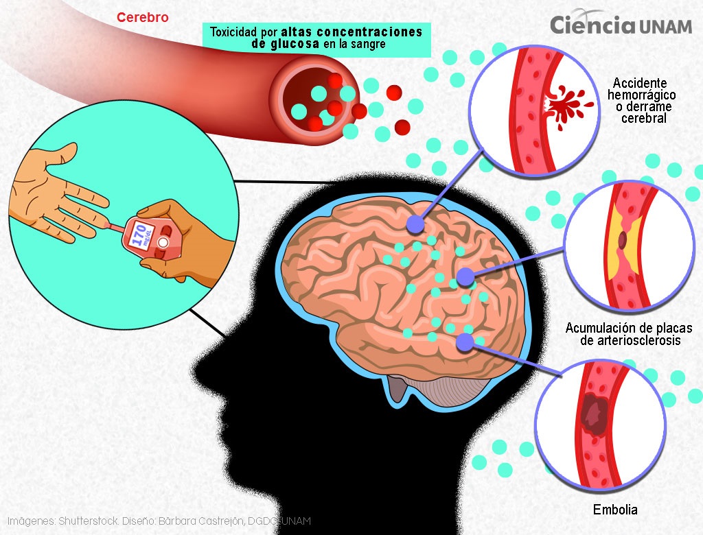 Influencia del Azúcar y Grasas en el Cerebro