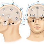 Interpretación y aplicaciones del electroencefalograma en la medicina moderna