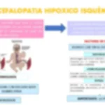 Profundiza en la Encefalopatía Hipóxica: causas y tratamiento