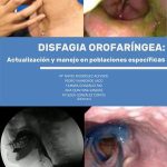 Propiedades y aplicaciones de la loxapina: guía concisa
