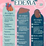 Clasificación de los distintos tipos de edemas