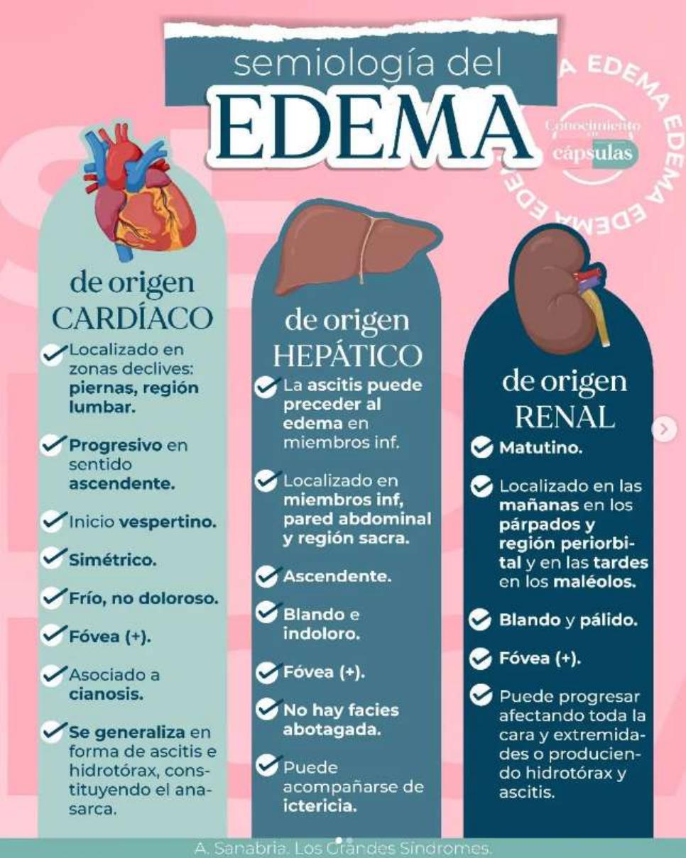 Clasificación de los distintos tipos de edemas