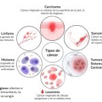 Variedades de Cáncer: Una Guia Esencial